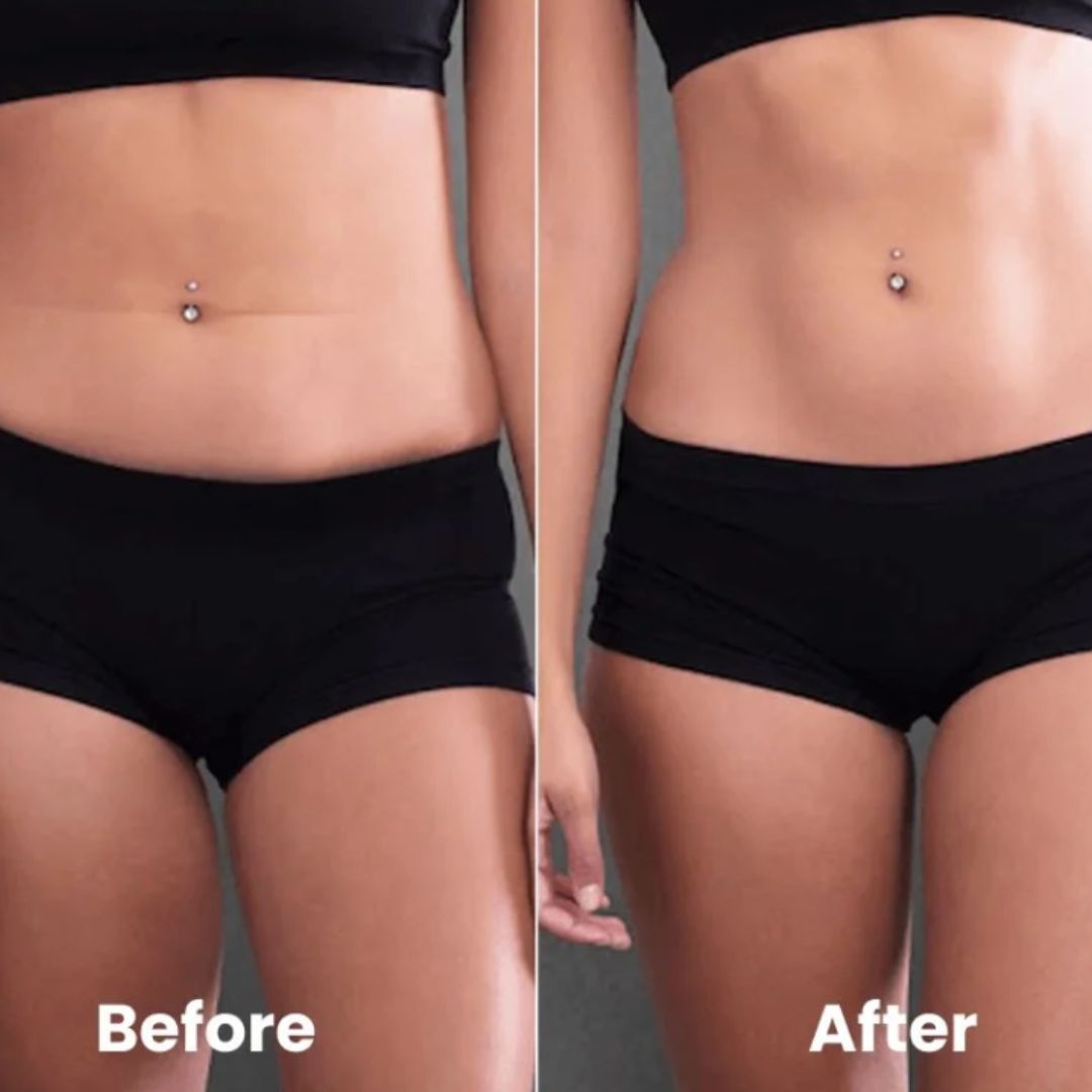 Abdomen and Flanks