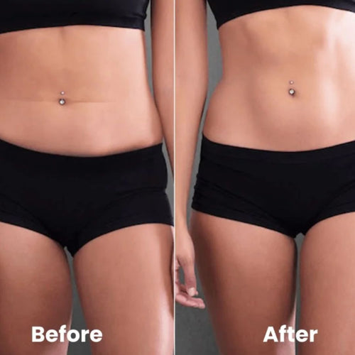 Abdomen and Flanks