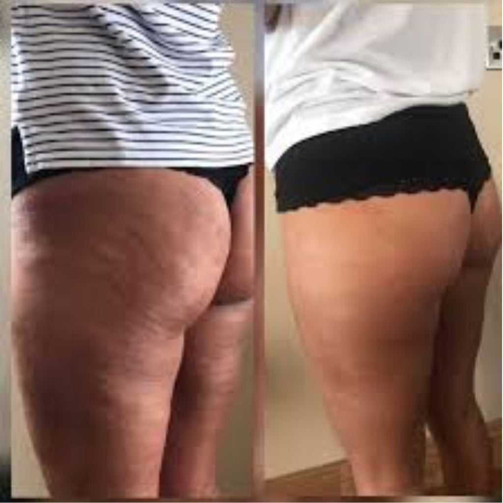 Glutes, Hips and Thighs