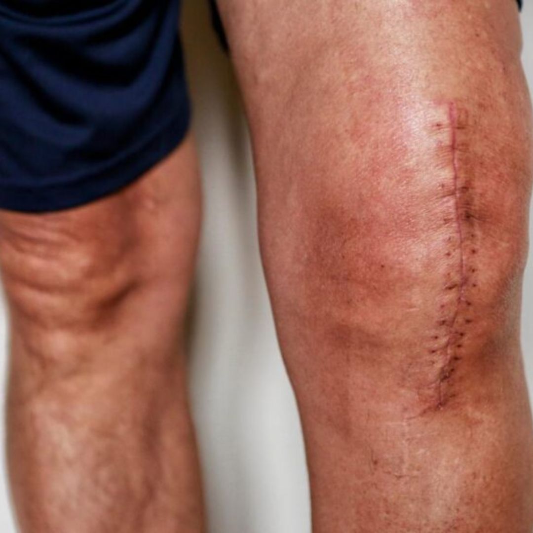 Post-Surgical Recovery Treatments Packages